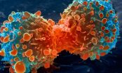 Nghiên cứu mới: Không phải do thực phẩm bẩn hay môi trường ô nhiễm, nguyên nhân hàng đầu gây ung thư là do lỗi sao chép DNA