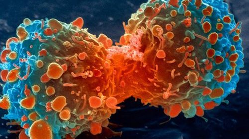Nghiên cứu mới: Không phải do thực phẩm bẩn hay môi trường ô nhiễm, nguyên nhân hàng đầu gây ung thư là do lỗi sao chép DNA